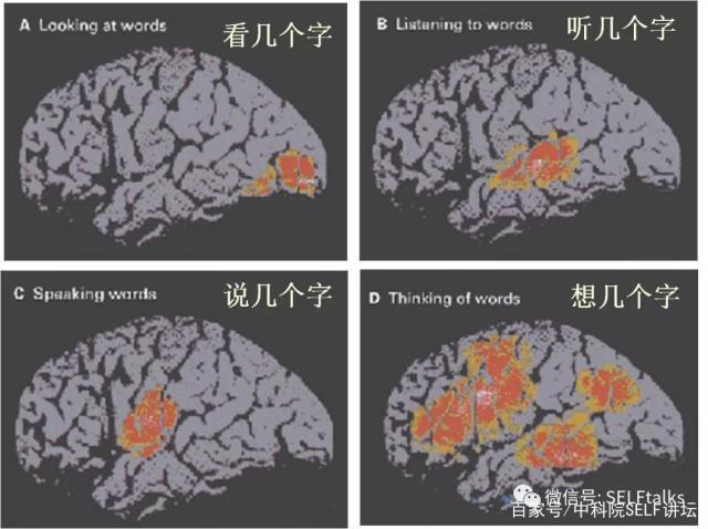 中國(guó)腦健康日關(guān)注“頭”等大事,中國(guó)腦科技的未來是什么?